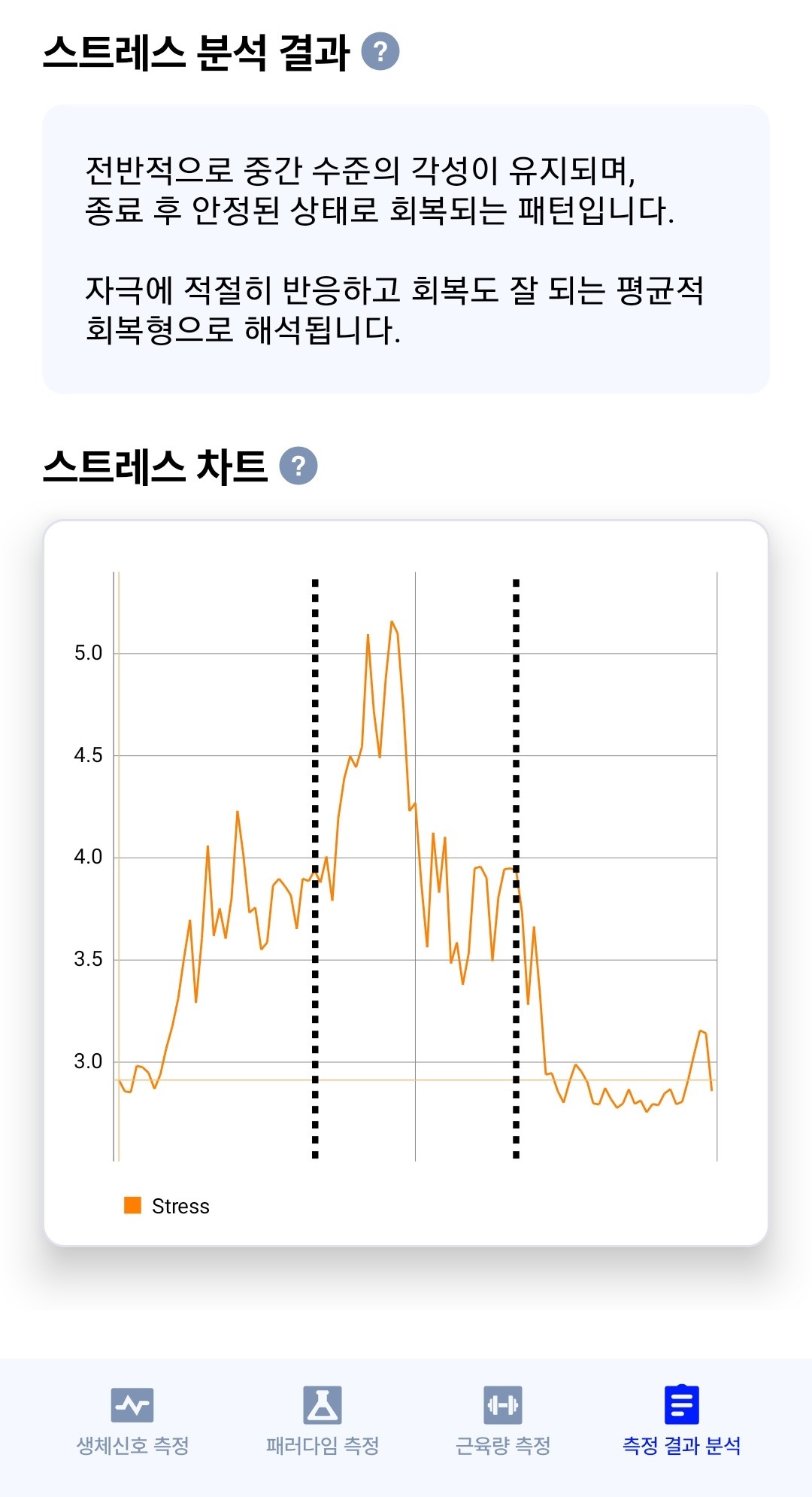 스트레스 분석 결과 페이지 — 스트레스 차트